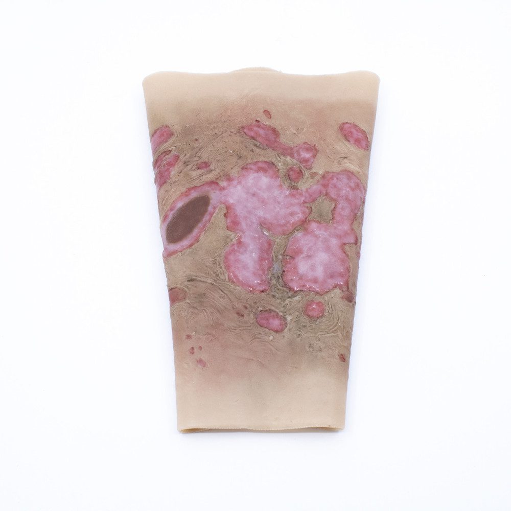 SWK05_01_1000px.jpg TRAUMASIM Wearable Large Burn – Forearm